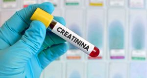 La creatinina en personas mayores de 50 años